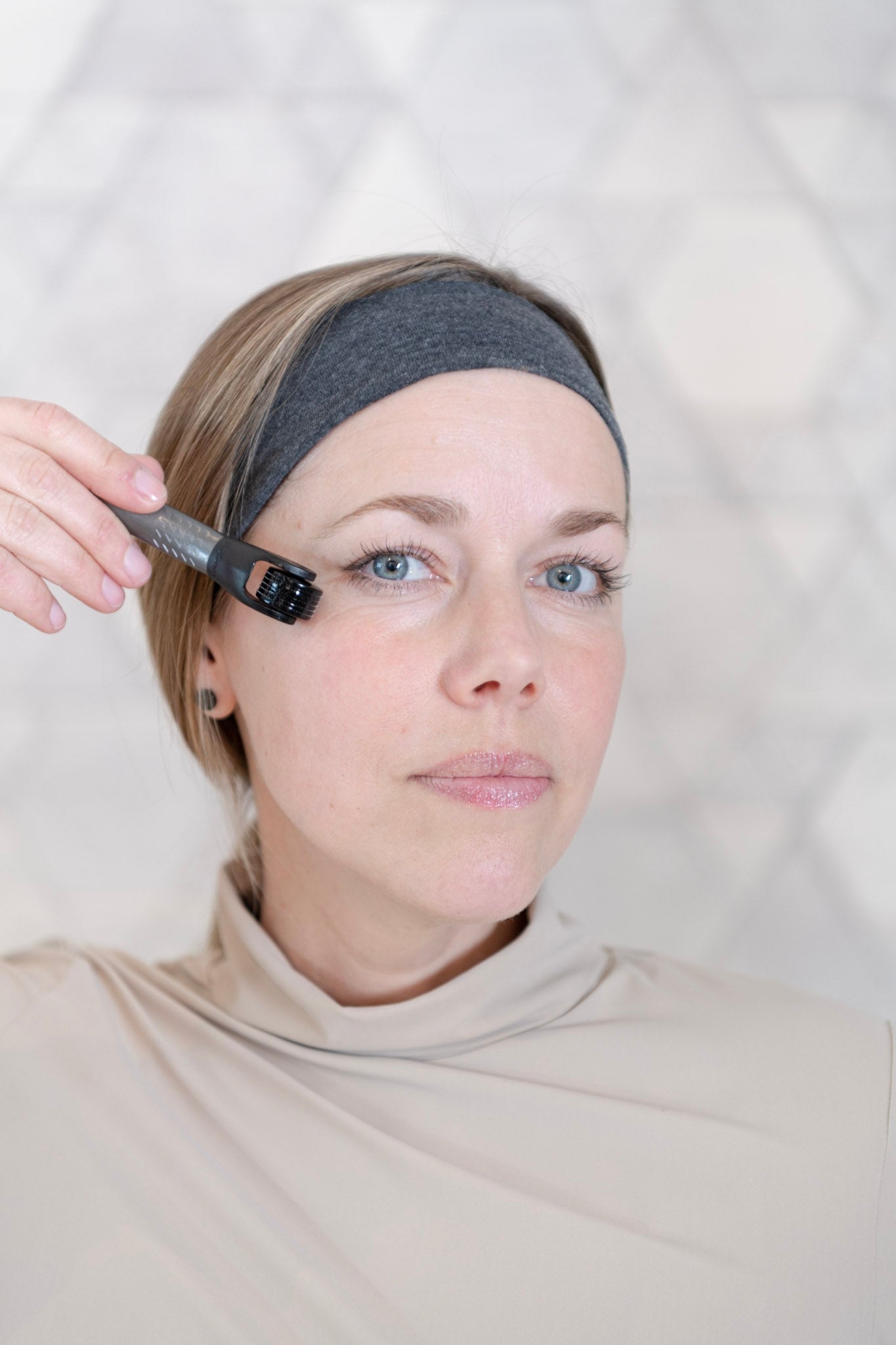 Is microneedling beter dan Botox