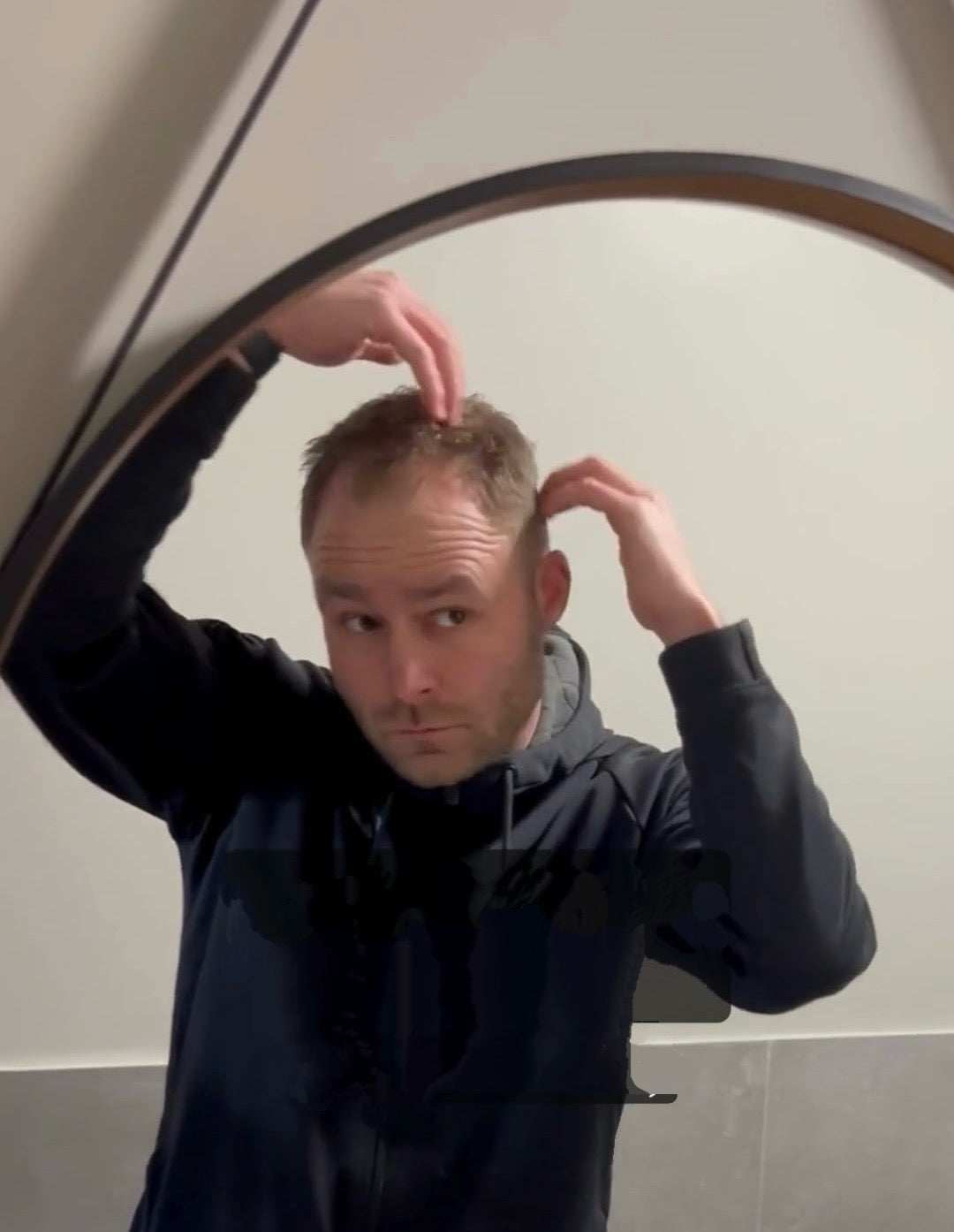 Dermarollen met Niek