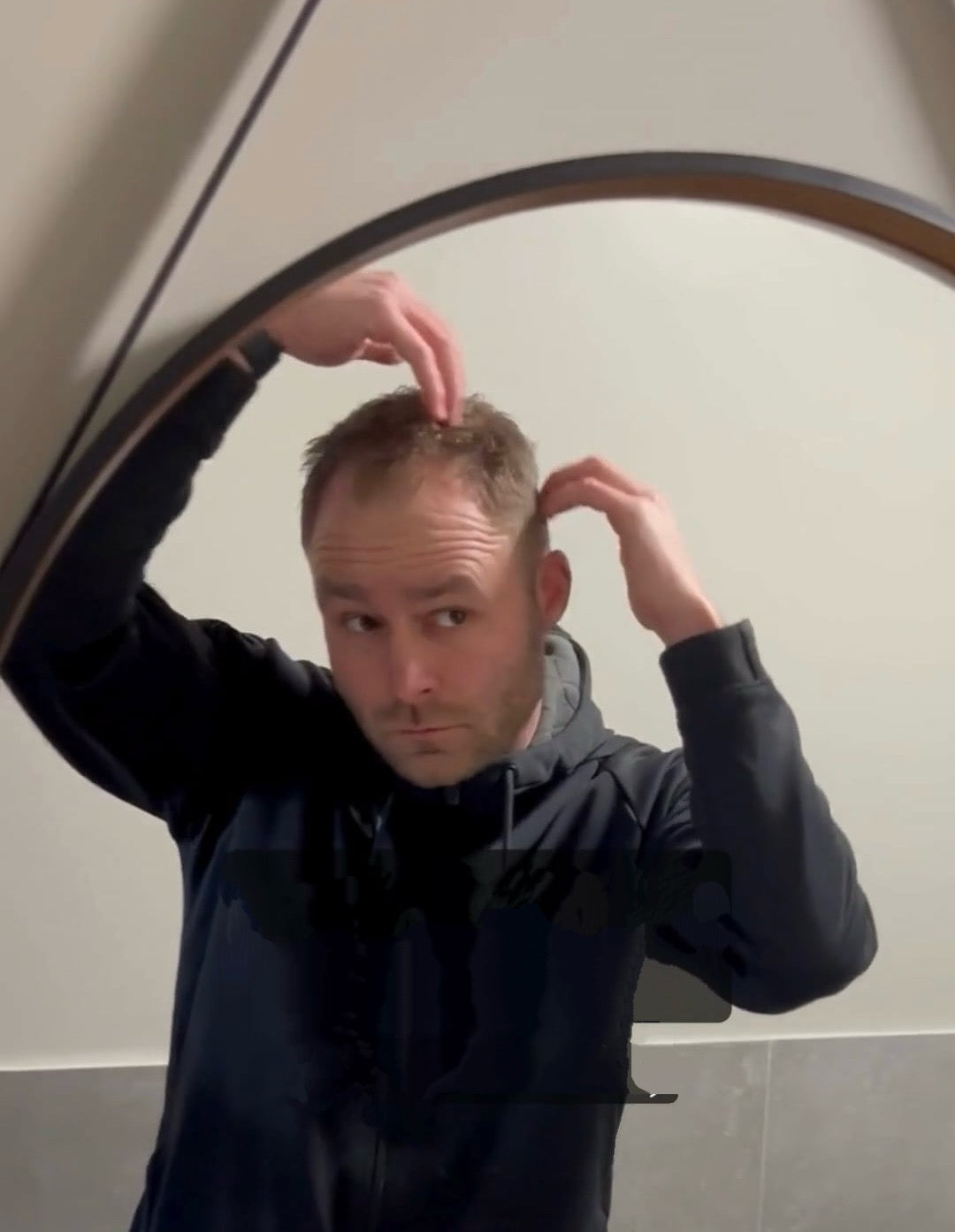 Dermarollen met Niek