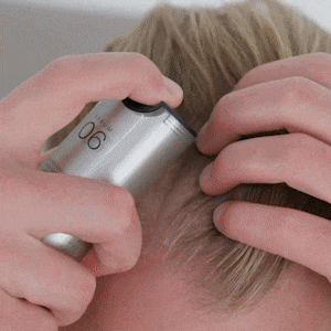 Haargroei Set met microneedling dermaroller en serum voor minder haaruitval en stimulatie van haargroei