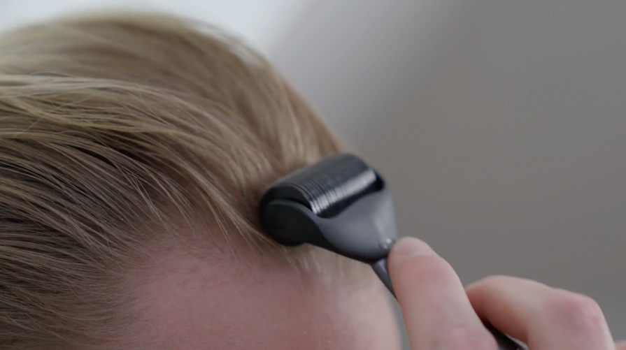 Dermarollerkop maat L met naalden 1.2 mm voor microneedling op lichaam en hoofdhuid