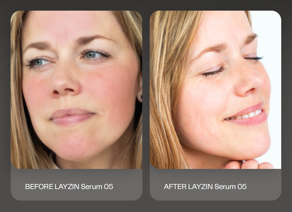 Kalmerend SERUM 05 voordelen